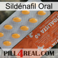 Sildénafil Oral 43